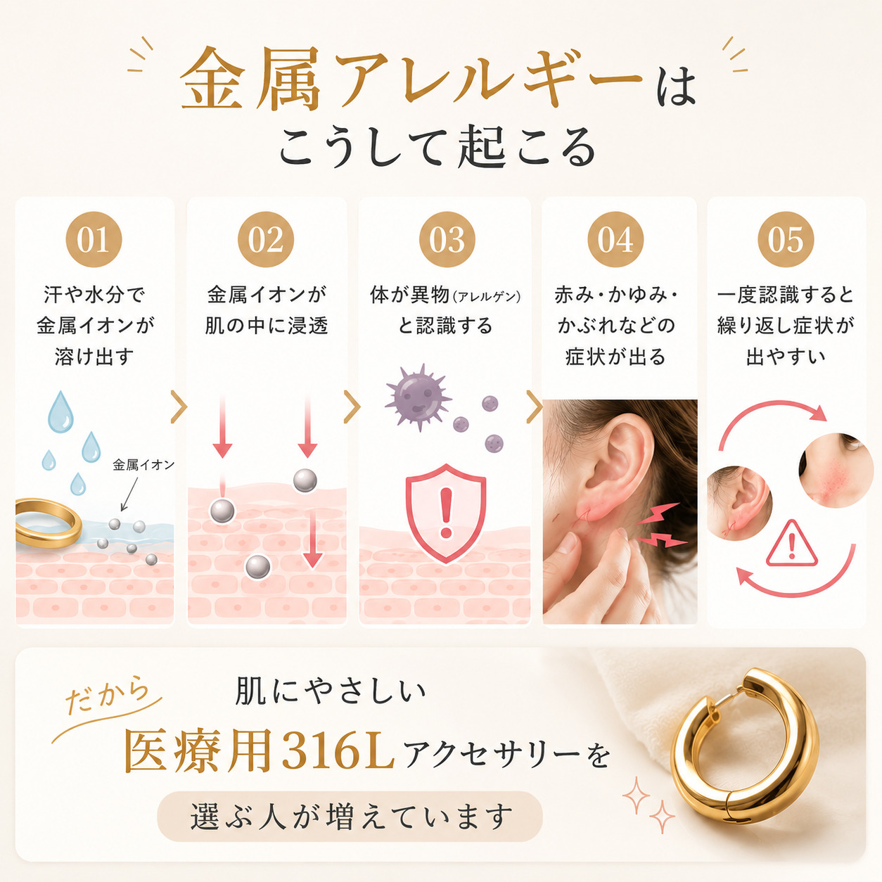 金属アレルギーのメカニズム 金属イオンと肌の反応